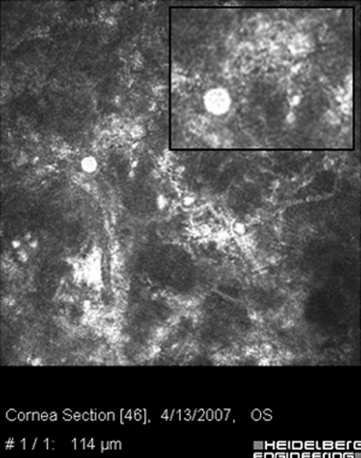 Acanthamoeba Microscopía Confocal