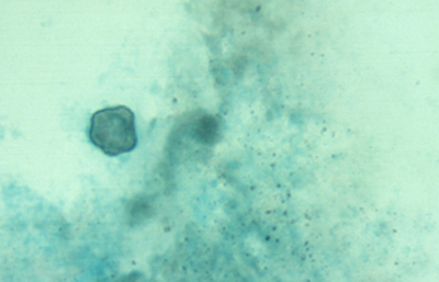 Acanthamoeba Grocott. Original x250