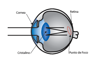 Diagrama Vision Astigmática