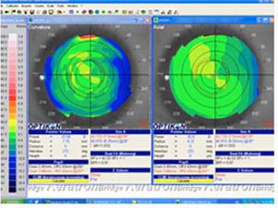 Topografía